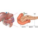 췌장암은 불치병? - 췌장암에 대한 성급한 오해 이미지