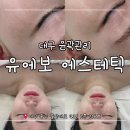 동성로 관광안내소 | 대구 윤곽관리:: '유에보에스테틱' 시그니처 작은얼굴 관리 후기 및 관리 순서 정리