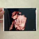 정은약국 | 임신기록 : 29~30주 / 임신 후기 일상 / 임산부 고열, 오한 대처법 임산부 항생제 후기