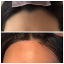 에이스헤어 (샵) | 일산 부작용 없이 매끄러운 헤어라인&amp;인중 왁싱 전문 에이스 왁싱