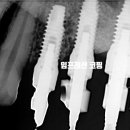 나온치과기공소 이미지