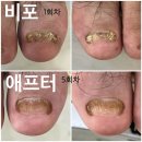 헤이네일