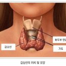 갑상선질환은 악성과 양성이 있습니다 이미지