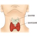 갑상선 기능 항진증[hyperthyroidism] 이미지