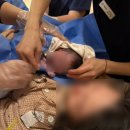 파수골목장2 | 양수터지고 얼떨결에 성공한 청담마리 초산 자연분만(양수파수,무통주사,태림법 콜라보) 출산후기