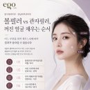 압구정피부과·강남피부과 추천 볼필러 vs 관자필러, 꺼진 얼굴 채우는 순서가 따로 있습니다