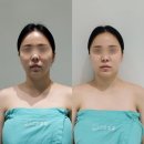 장유프라자 | 고운빛깔 김해 장유점에서 받은 김해 피부관리 비대칭에 도움준 4D대작관리 체험 후기