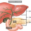 담도암 이미지