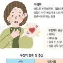 심방세동 부정맥 원인 증상 치료 심장 돌연사 이미지