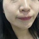 대연동 페이스왁싱 실면도 후기 / 화잘먹 [은정루미스킨]