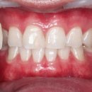 머물고싶은치과의원 이미지