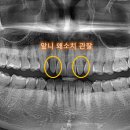더굿치과의원 네이버블로그