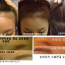 스타헤어라인 네이버블로그