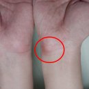 마일드팜 이미지