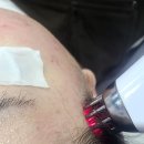 20 | 의정부호원동두피관리 후기 – 20대인데 정수리 비어 보이는 느낌… 불안해서 받아본 솔직 경험담