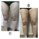 속초스트롱짐 이미지