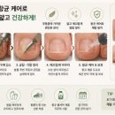 앙뚜네일 | ᰔ부산 용호동 네일 | 발톱 균집 생기는 원인ᰔ