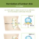 명제한의원 이미지