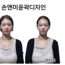 손앤미뷰티스킨