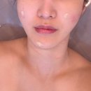 문제성피부 인천주안피부관리 아름다움에스테틱 뉴에르모듀 관리 후기