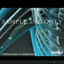 3D Medical Animation - Lumpectomy, Mastectomy Breast Cancer Surgery 이미지