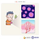깎아아 | 티눈 사마귀 구별 방법 알려드림 (사마귀 티눈 차이)