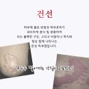 고운누리한의원이리라 네이버블로그