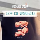 제주대학교 보건복지대학원 | 쌍둥이 임신 10~12주차 일상 | 1차 기형아검사, 정부24 맘편한 임신(교통비,ktx할인),우체국 무료보험