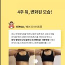 주톡스 이미지