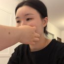 더블유테라피 | 대구 만촌동 피부관리 더블유테라피 하이푸리프팅 받고 얼굴선 살아난 후기