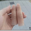 신세계 의수족 연구소 이미지