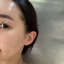 내포피부관리 유미뷰티 솔직후기