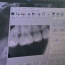 에이라인치과병원 | 청주 에이라인 치과 검진받은 후기