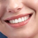 루시아치과의원 이미지