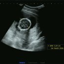 윤은숙산부인과의원 이미지