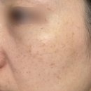 크림약국 | 약국 기미크림 2주 사용 후기, 이건 좀 달랐어요