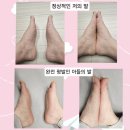 (주)팔레스에어코리아 | 건강 엔토 엔토 펌핑 에어 아치 인솔 족저근막염깔창, 평발깔창 후기