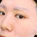 (주)세로 | 뷰티 디바이스 추천 코모공 관리 나비존 세로모공 줄이는법 식스킨 타이트샷 2주 효과