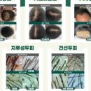 도노포레스타