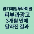 맘카페침투바이럴 피부과광고 성공한 케이스