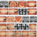 구(고경) 이미지