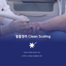 100세 시대 건강도 경영하라 | 100세 부모님 두꺼운발톱 안전한 스케일링 Toenail Scaling