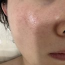 주엽피부관리 모공풀케어관리 라인피부관리실 솔직후기