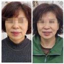 💆‍♀️ 의왕피부관리 180도스킨샵 방문 후기! 피부가 진짜 180도 달라짐!✨