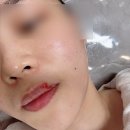 6064 | 동작 인더뷰티:: 이수역피부관리 단골 많은 곳 | 슈퍼젝션 후기