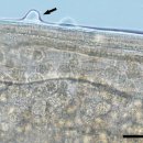 Philometroides seriolae유충에 감염된 Tigriopus japonicus를 먹인 방어에서의 선충류 감염 이미지