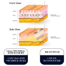 닥터김메디코스의원 | 청담 소프웨이브, 후기보다 중요한 ‘이것’ 이 글에서 확인하세요