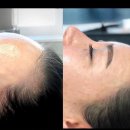 모델헤어라인 이미지