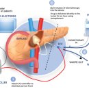 췌장암의 새로운 치료법 IOP(Iontophoretic Oncology Platform, 이온영동 종양학 플랫폼) 이미지