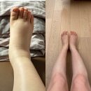 준희에스테틱 | 삼성미즈 산후조리원 제이휴마사지 후기:)